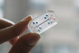 Organ-on-a-chip